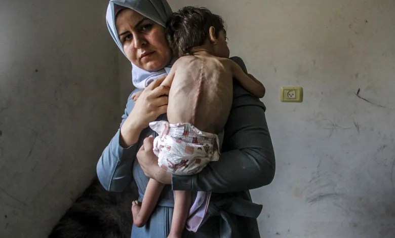 Gaza: aumentano nascite premature e malformazioni congenite