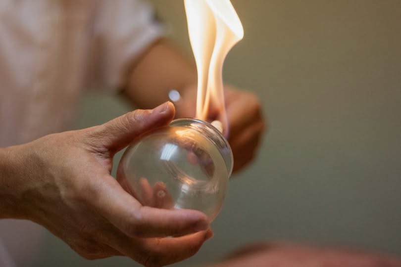 LA MEDICINA TRADIZIONALE CINESE IN BREVE